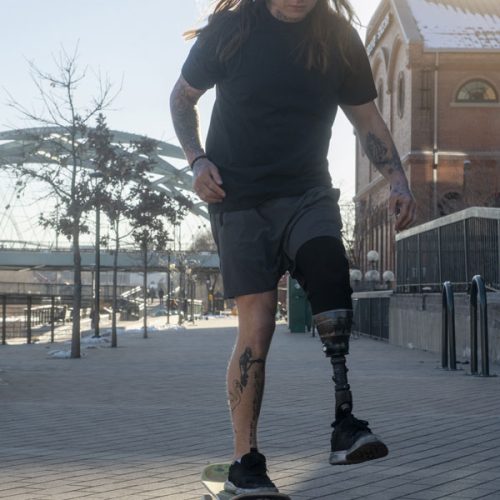 Proceso-Despues-de-una-Amputacion